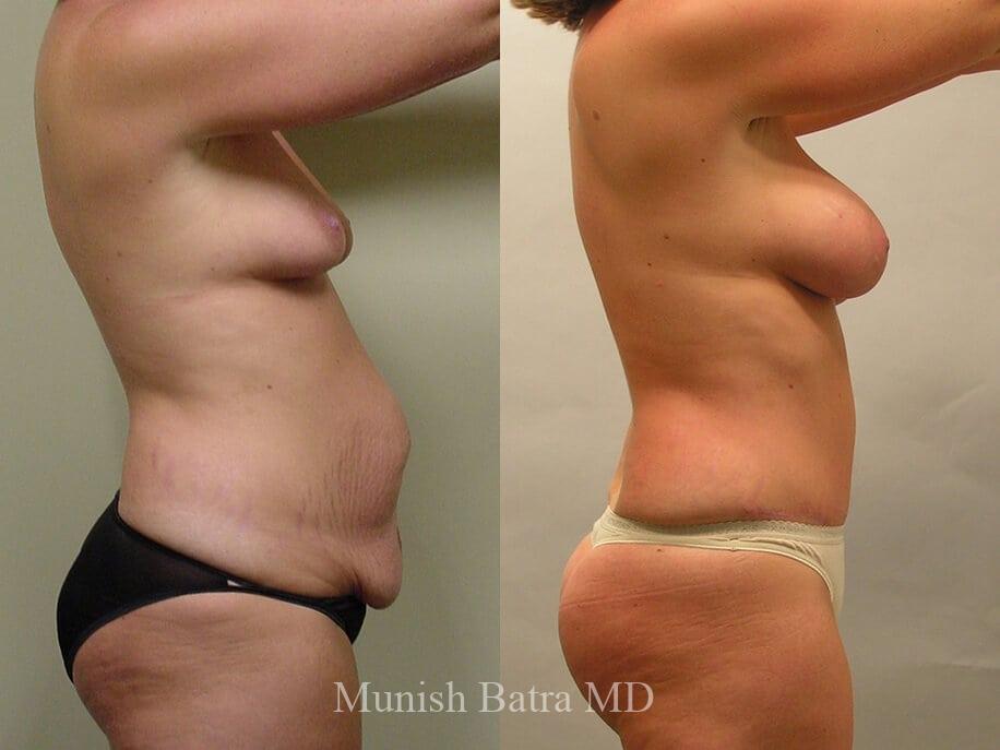 Before and After Image