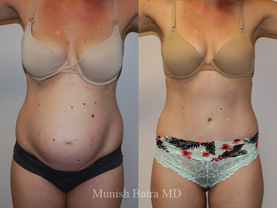 Before and After Image