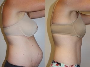 Before and After Image