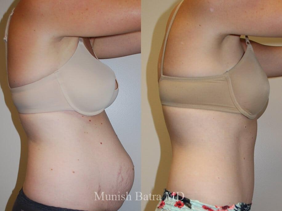 Before and After Image