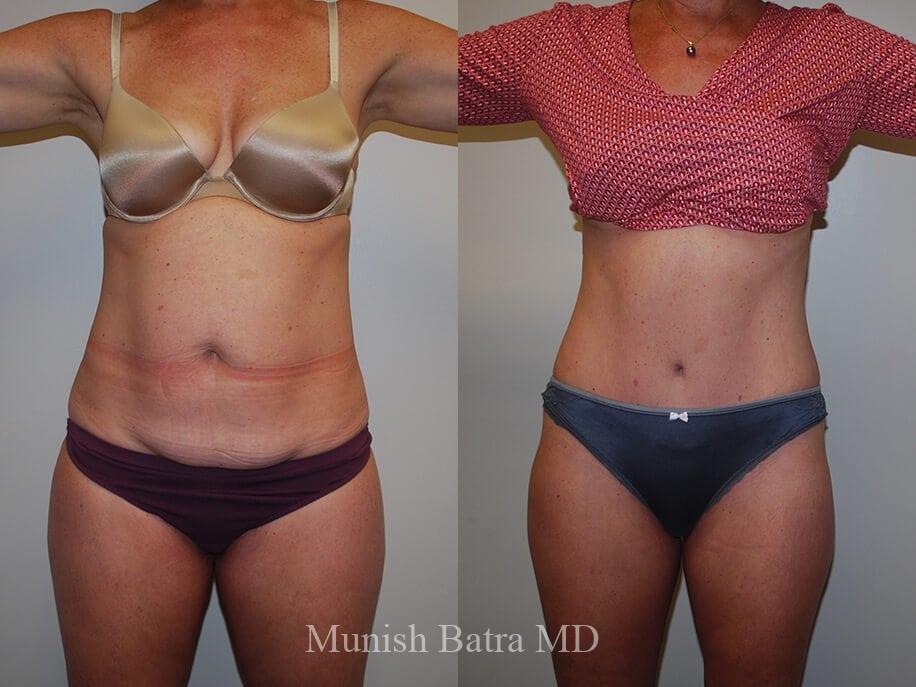 Before and After Image