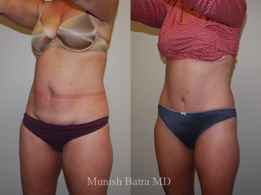 Before and After Image