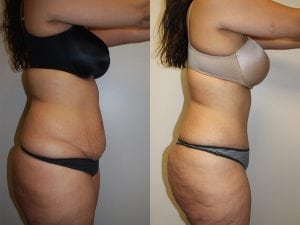 Before and After Image