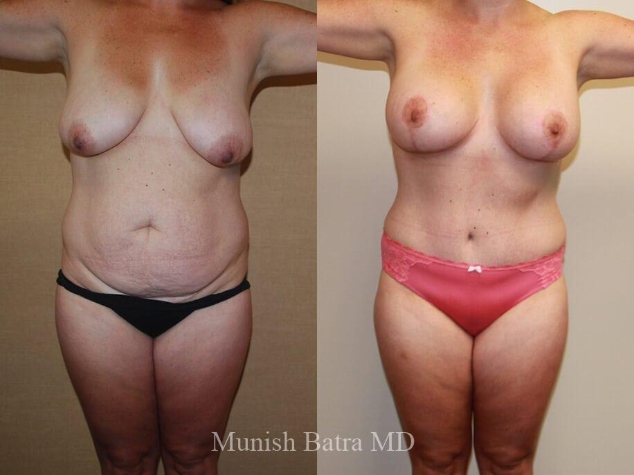 Before and After Image