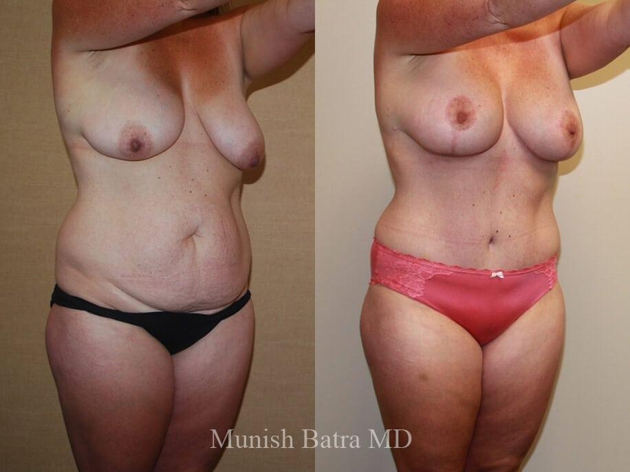 Before and After Image