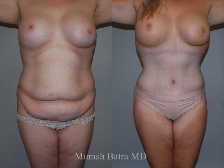 Before and After Image