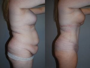 Before and After Image