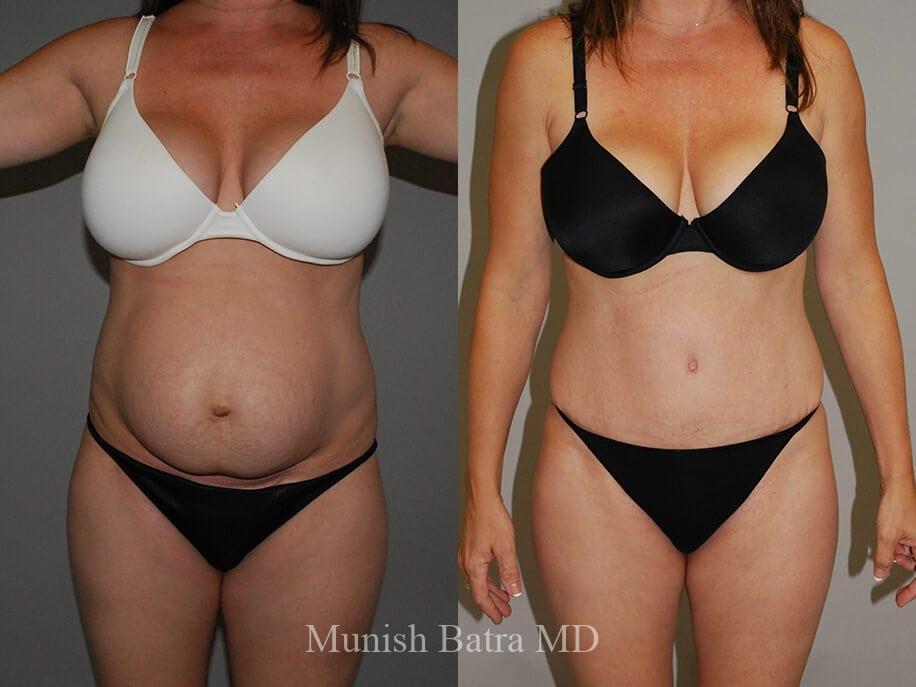 Before and After Image