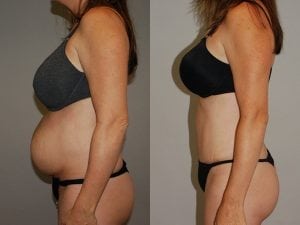 Before and After Image