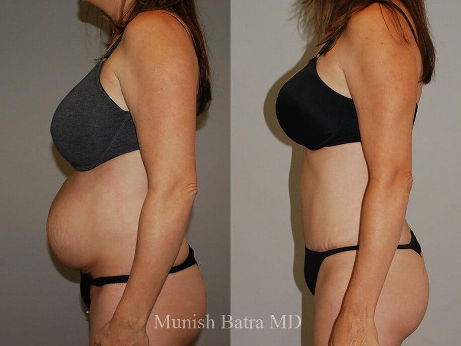 Before and After Image