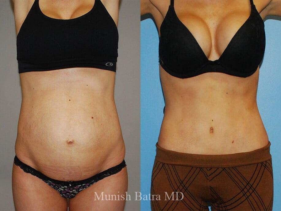 Before and After Image