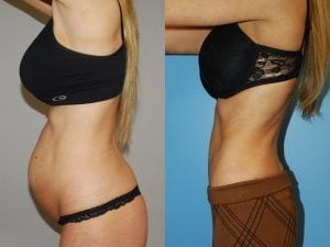 Before and After Image