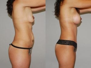 Before and After Image
