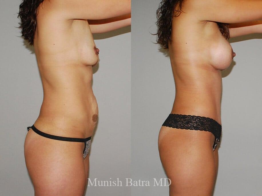 Before and After Image
