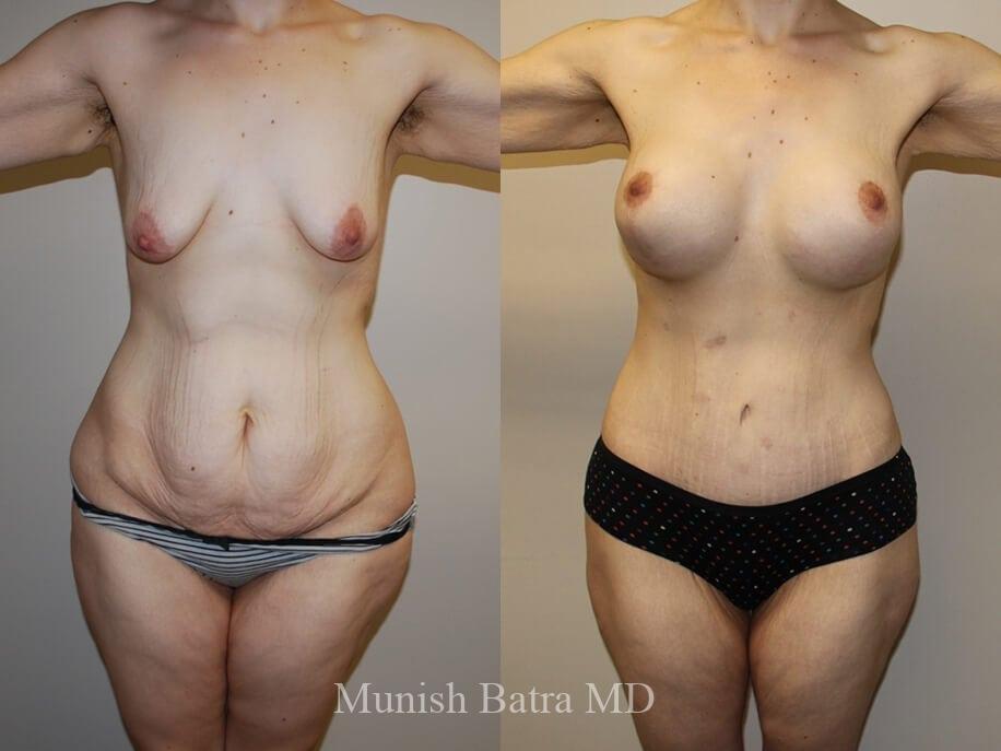 Before and After Image