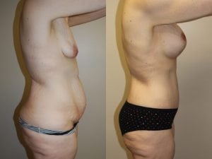 Before and After Image
