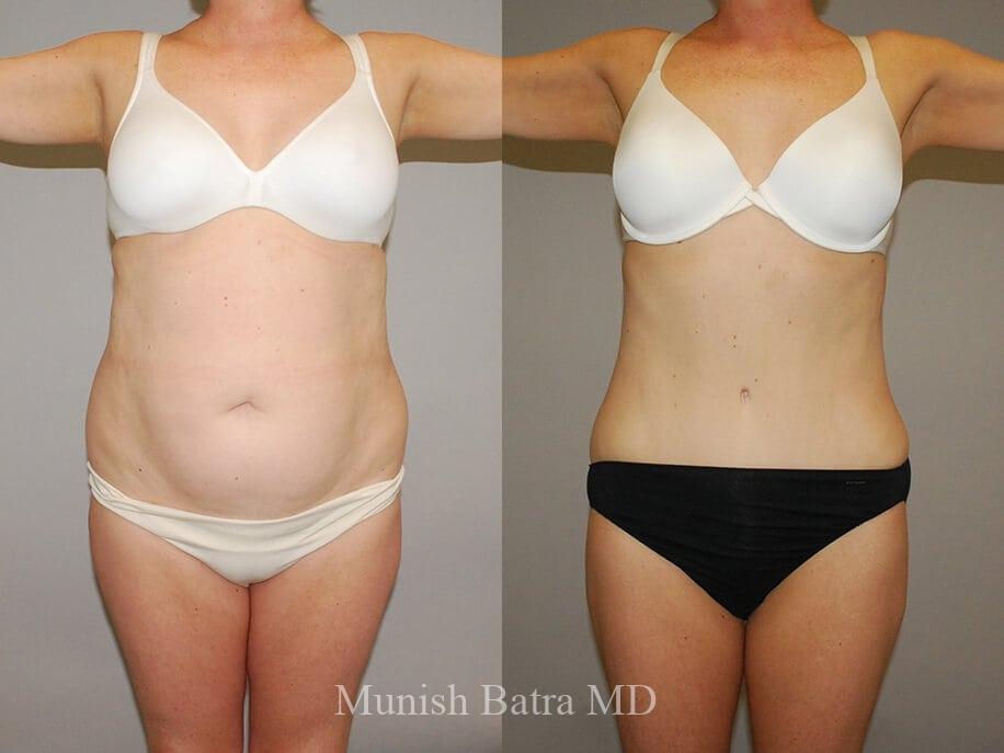 Before and After Image