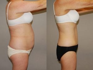 Before and After Image