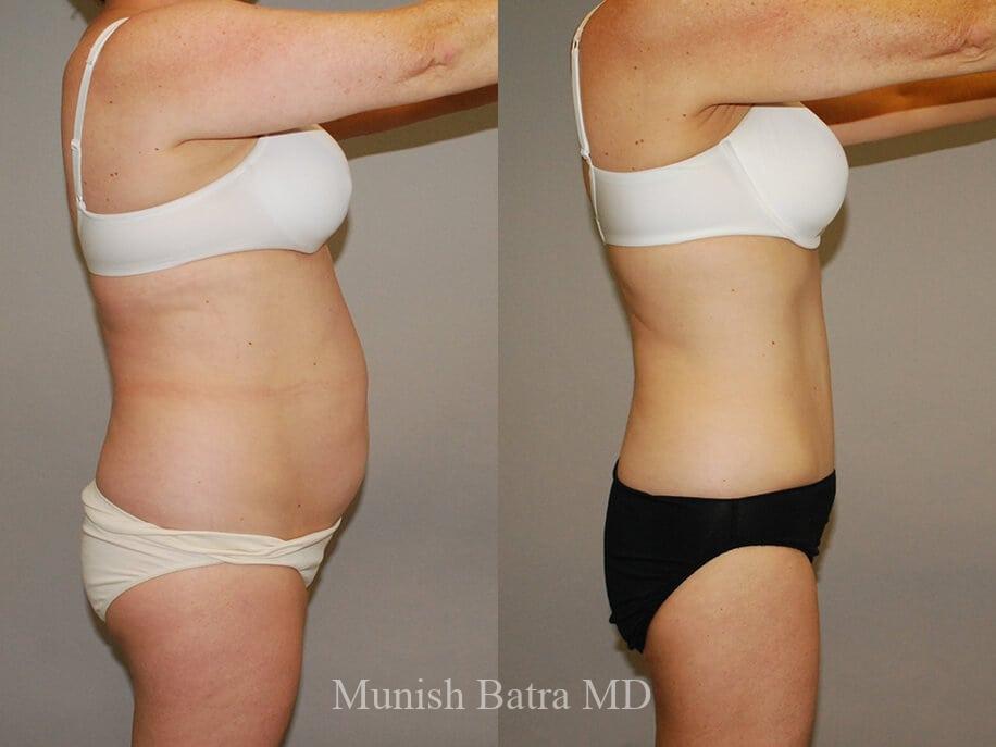 Before and After Image