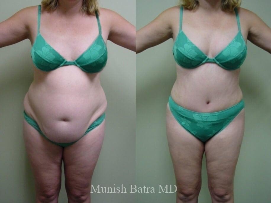 Before and After Image