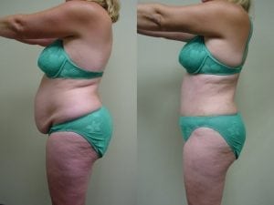 Before and After Image