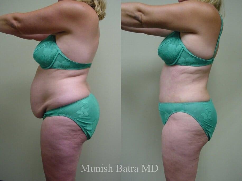 Before and After Image