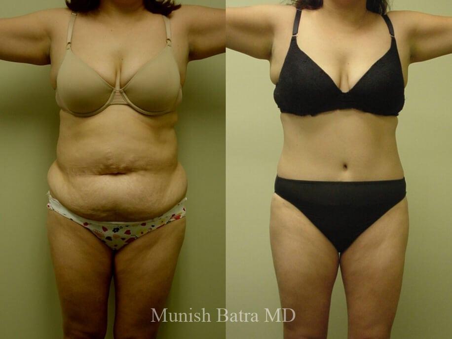 Before and After Image