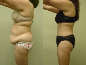 Before and After Image