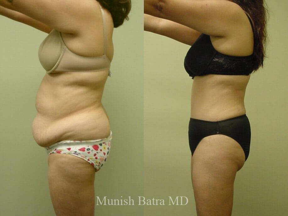 Before and After Image