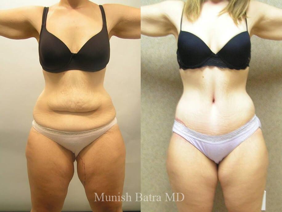 Before and After Image