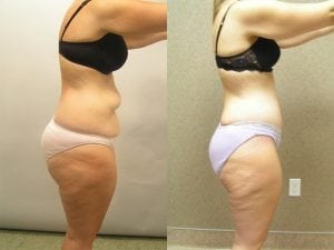 Before and After Image