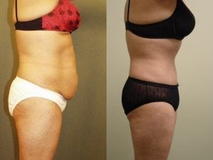 Before and After Image