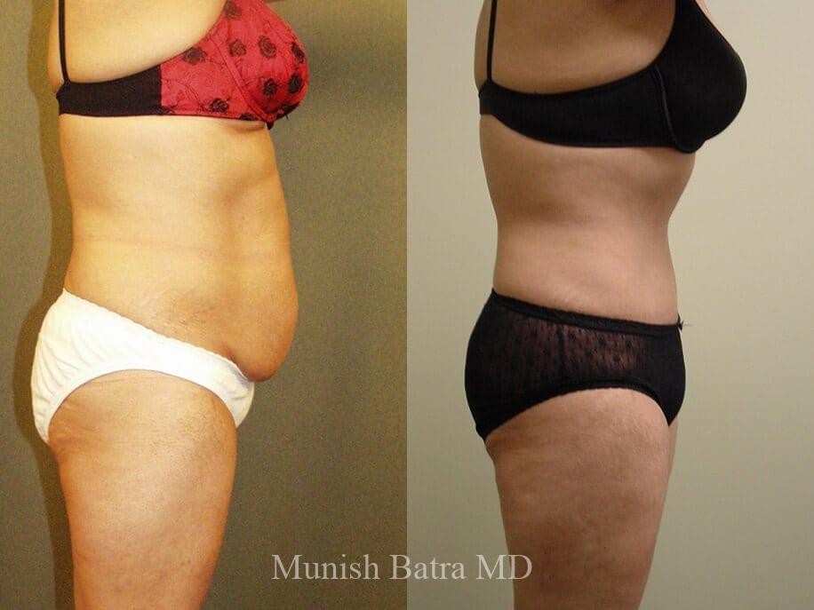 Before and After Image