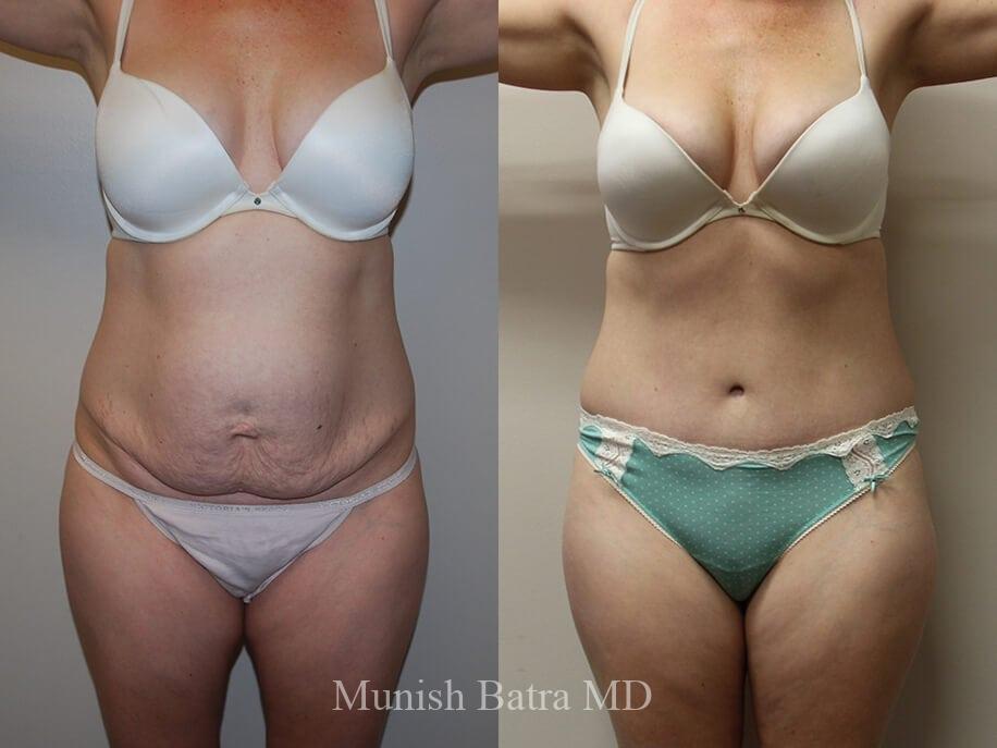 Before and After Image