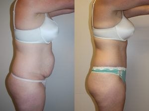 Before and After Image