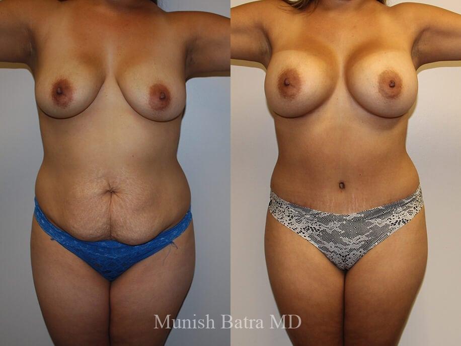 Before and After Image