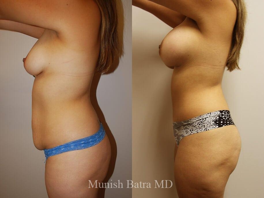 Before and After Image
