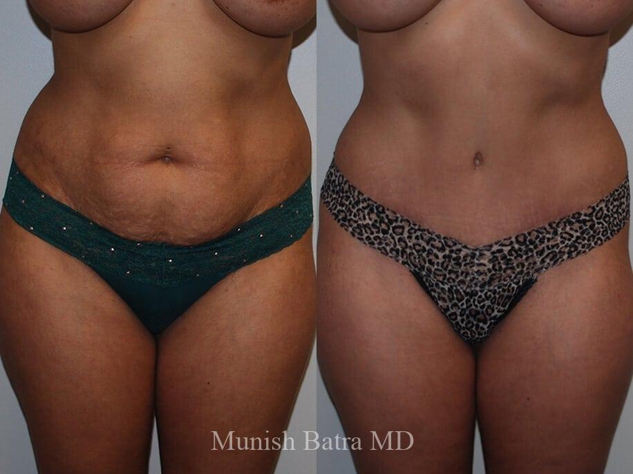 Before and After Image