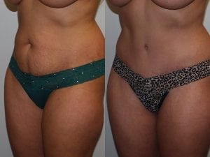 Before and After Image