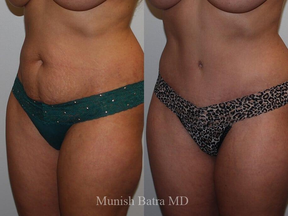Before and After Image