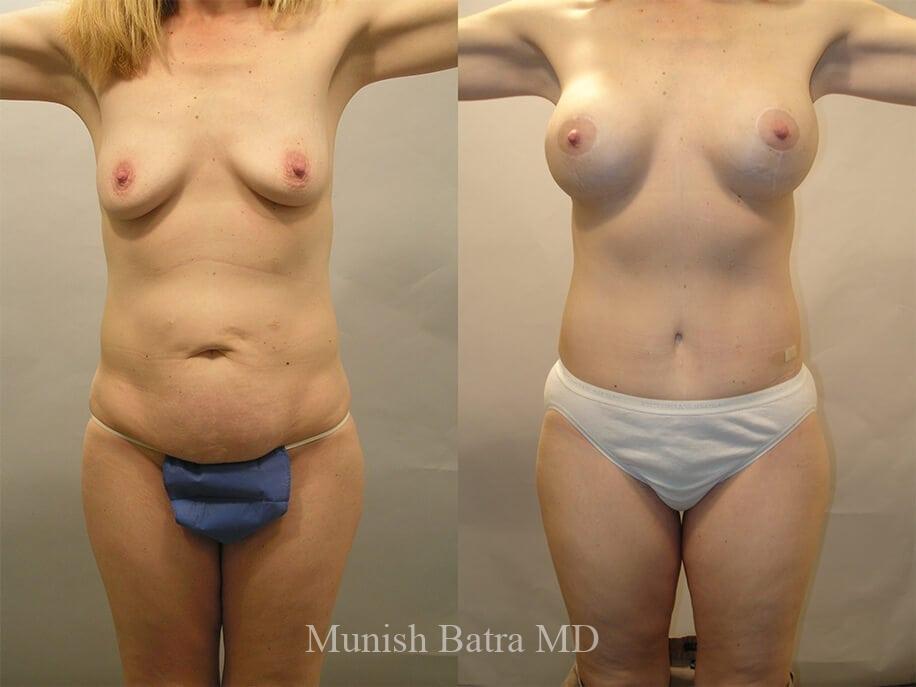 Before and After Image