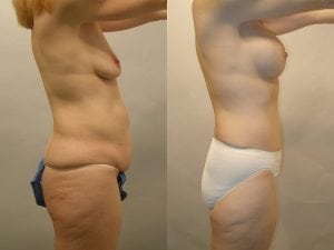 Before and After Image