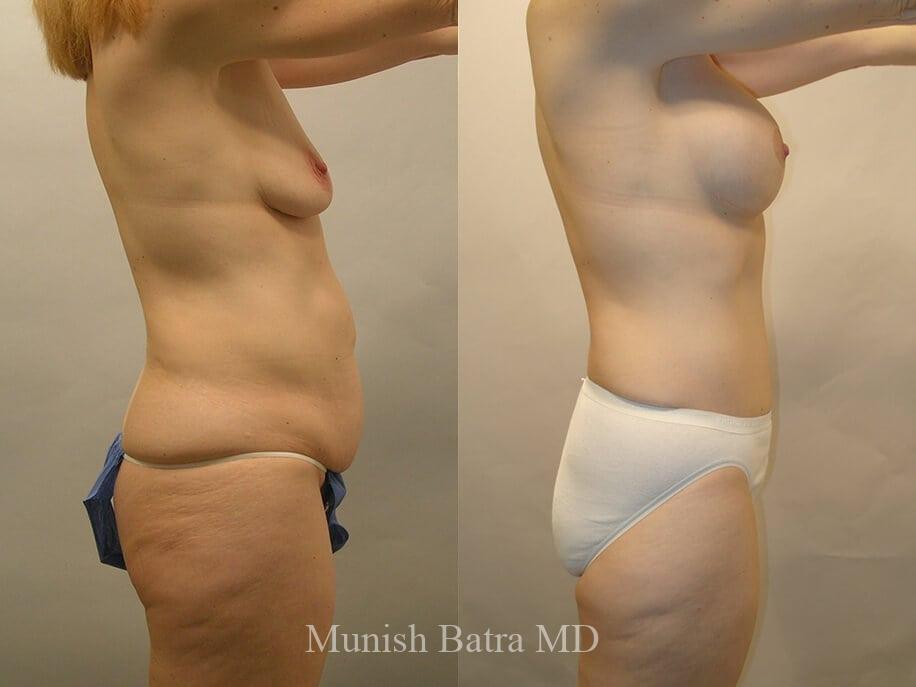 Before and After Image