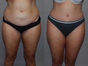Before and After Image