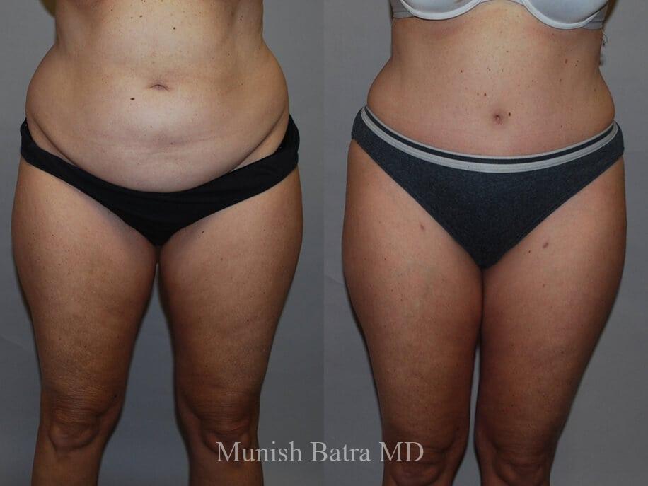 Before and After Image