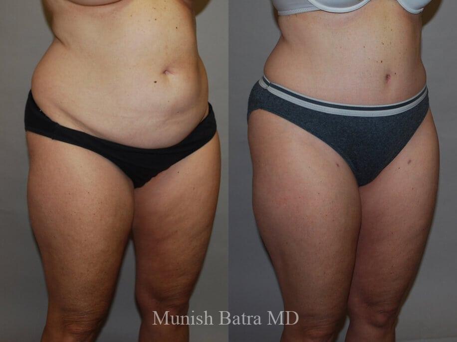 Before and After Image