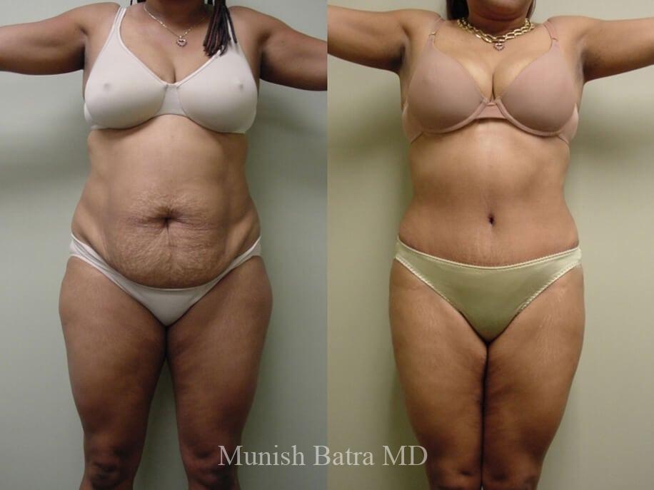 Before and After Image