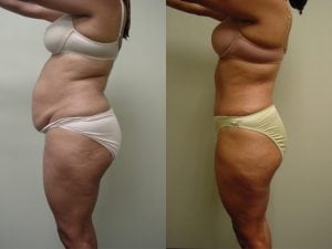 Before and After Image