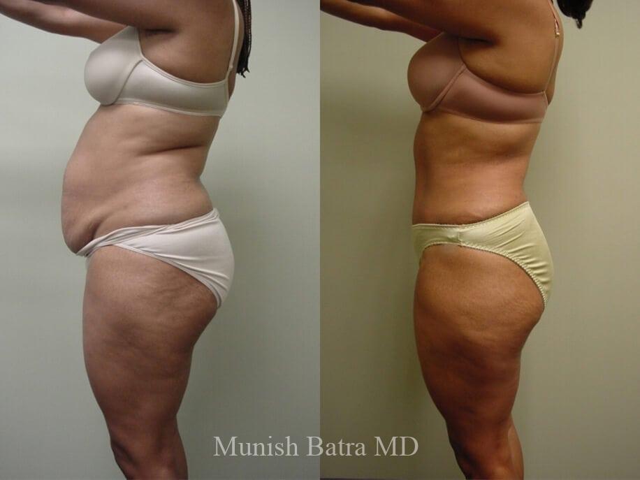 Before and After Image