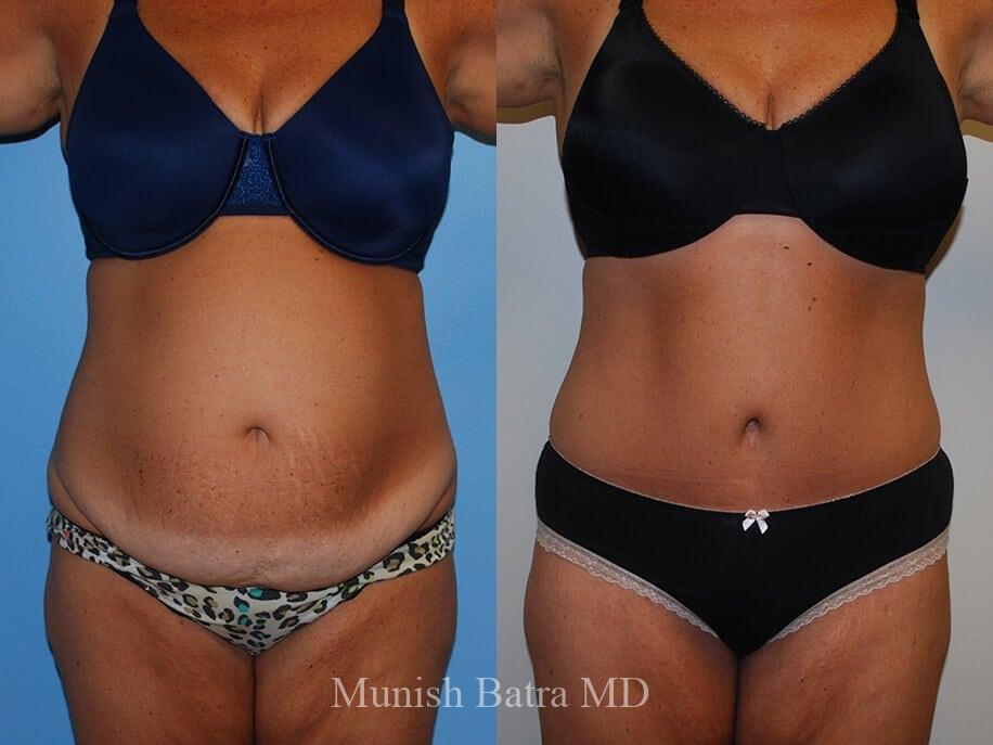 Before and After Image